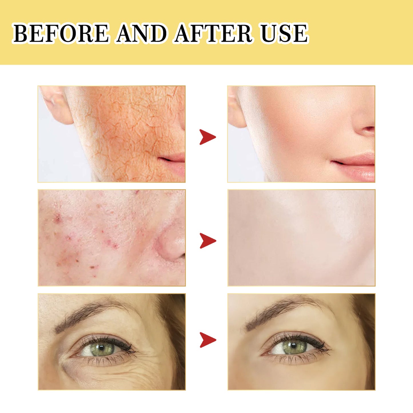 YouthLift™ Snail Peptide Power Essence