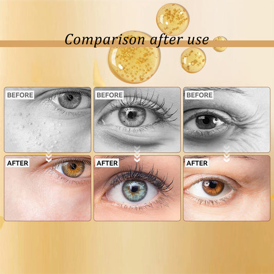LumiEyes™ Snail Peptide Eye Serum